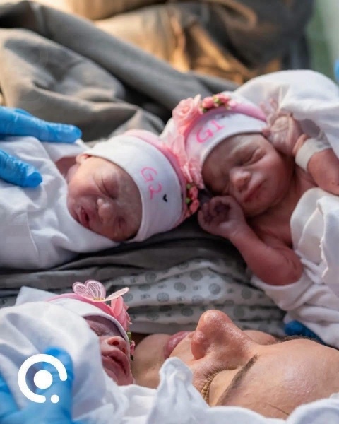 Trigêmeas nascem em parto humanizado e encantam equipe médica em hospital de Tubarão
